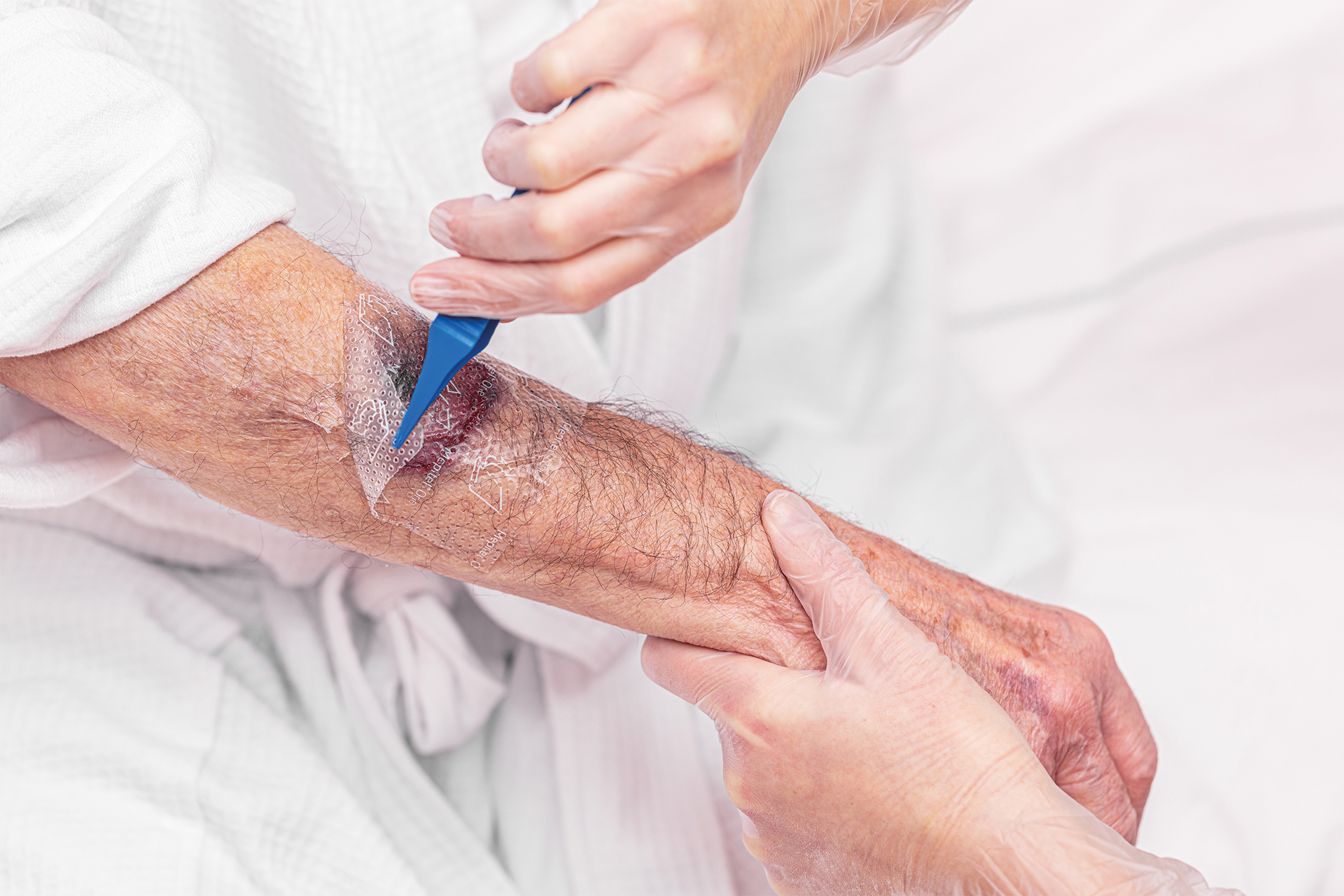 Profesional sanitario observando la mano de una señora de edad avanzada